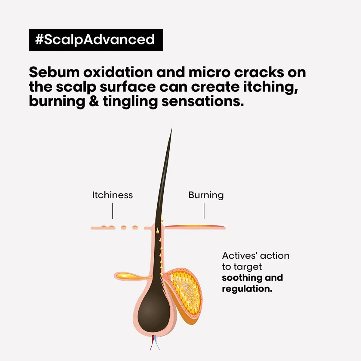 LOREAL SCALP ADVANCE TREATMENT 200ML