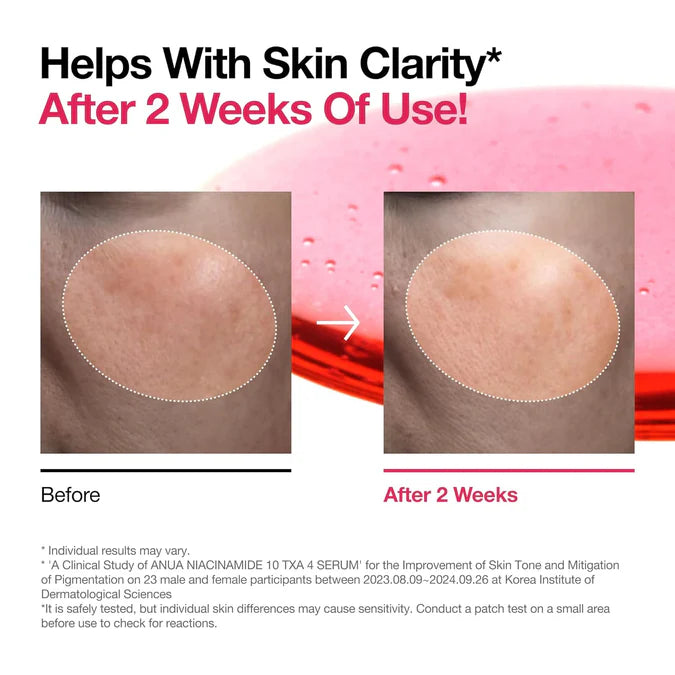 ANUA NIACINAMIDE 10% + TXA 4% DARK SPOT CORRECTING SERUM