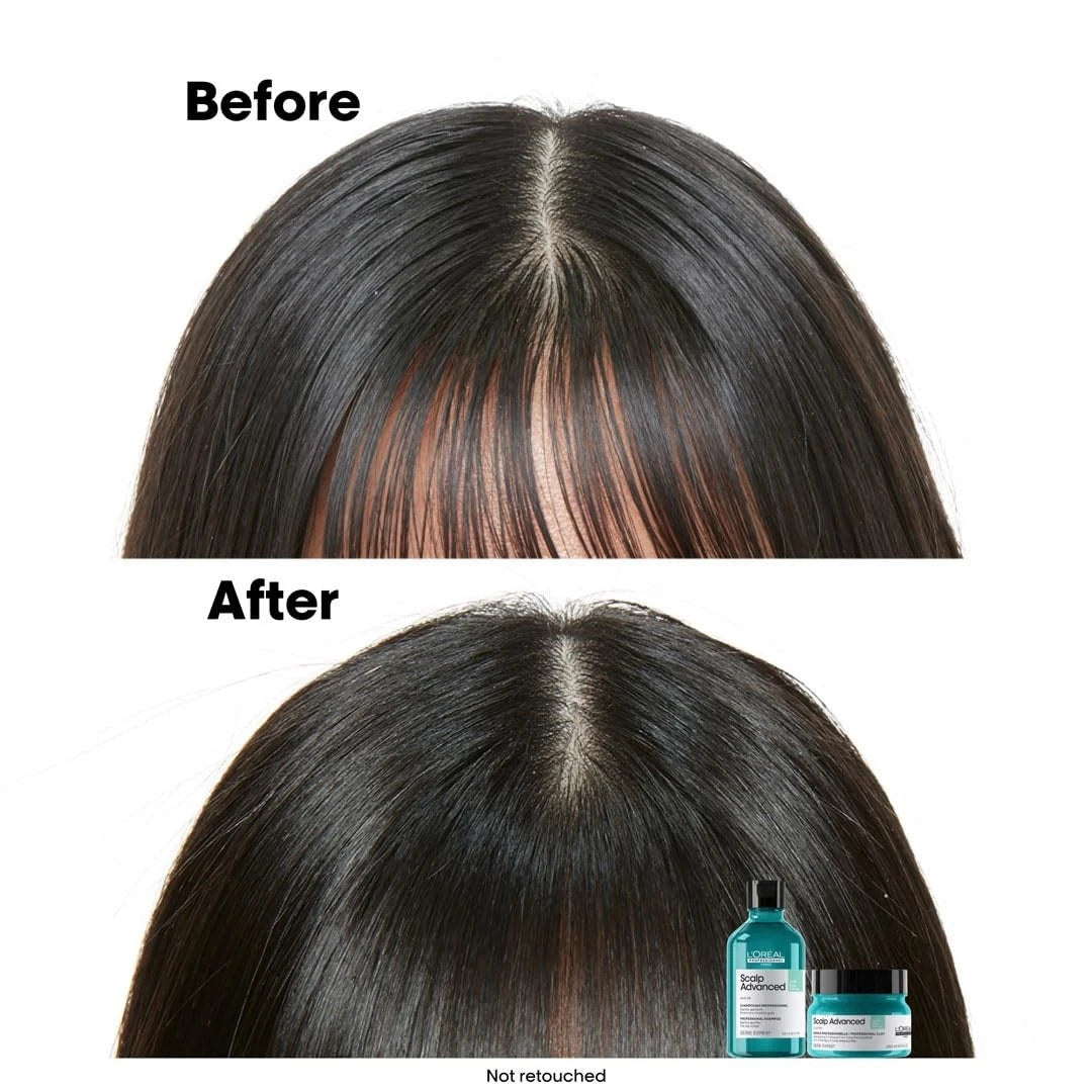 LOREAL SCALP ADVANCE MASK 250ml